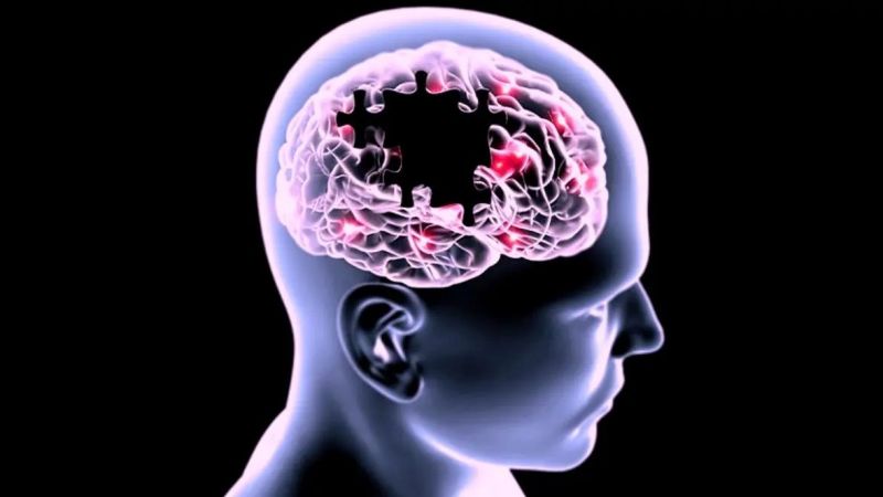 Uzmanlar Alzheimer’a Karşı Önlem Maddelerini Açıkladı! Bu Beslenme Alışkanlıkları Hafızanızı Güçlendirecek! 2
