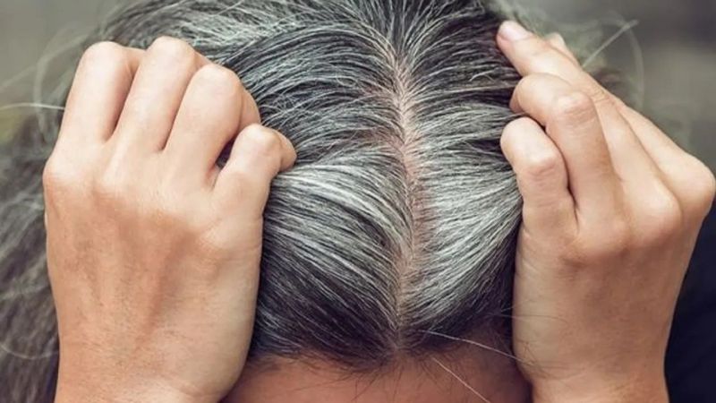Saç Beyazlaması İçin Ünlü Alimden Formül! İbn-İ Sina’nın Bin Yıl Önce Açıkladığı Çözümle Sağlıklı Saçlar! 3