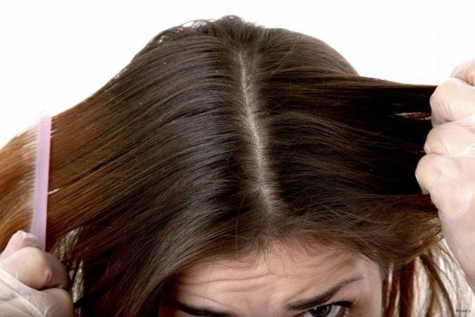 Saç diplerinizde bu belirtiler ortaya çıktıysa hemen doktora gidin: Kel kalmadan çaresine bakın… Küçük bir bölgede başlayıp yayılıyor 2