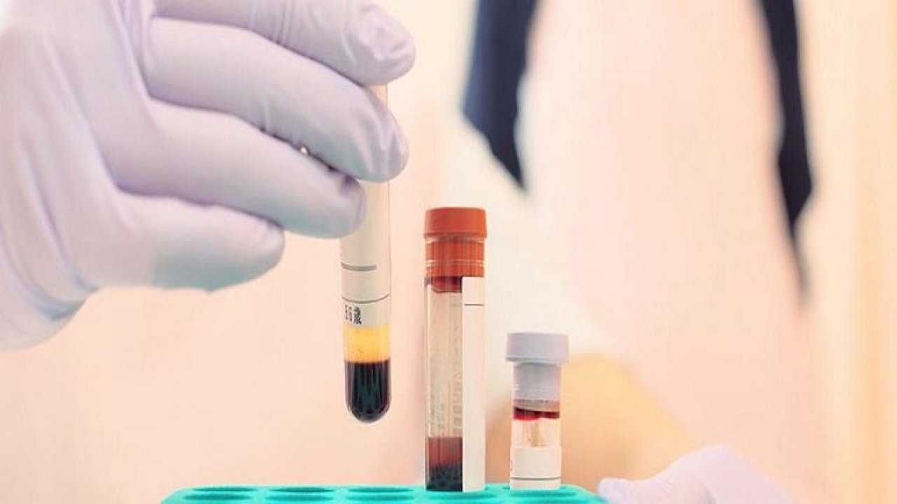 Hiv Testi Nasıl Yapılıyor?