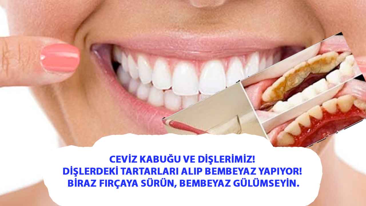 Ceviz Kabuğu ve Dişlerimiz! Dişlerdeki tartarları alıp bembeyaz yapıyor! Biraz fırçaya sürün, bembeyaz gülümseyin.