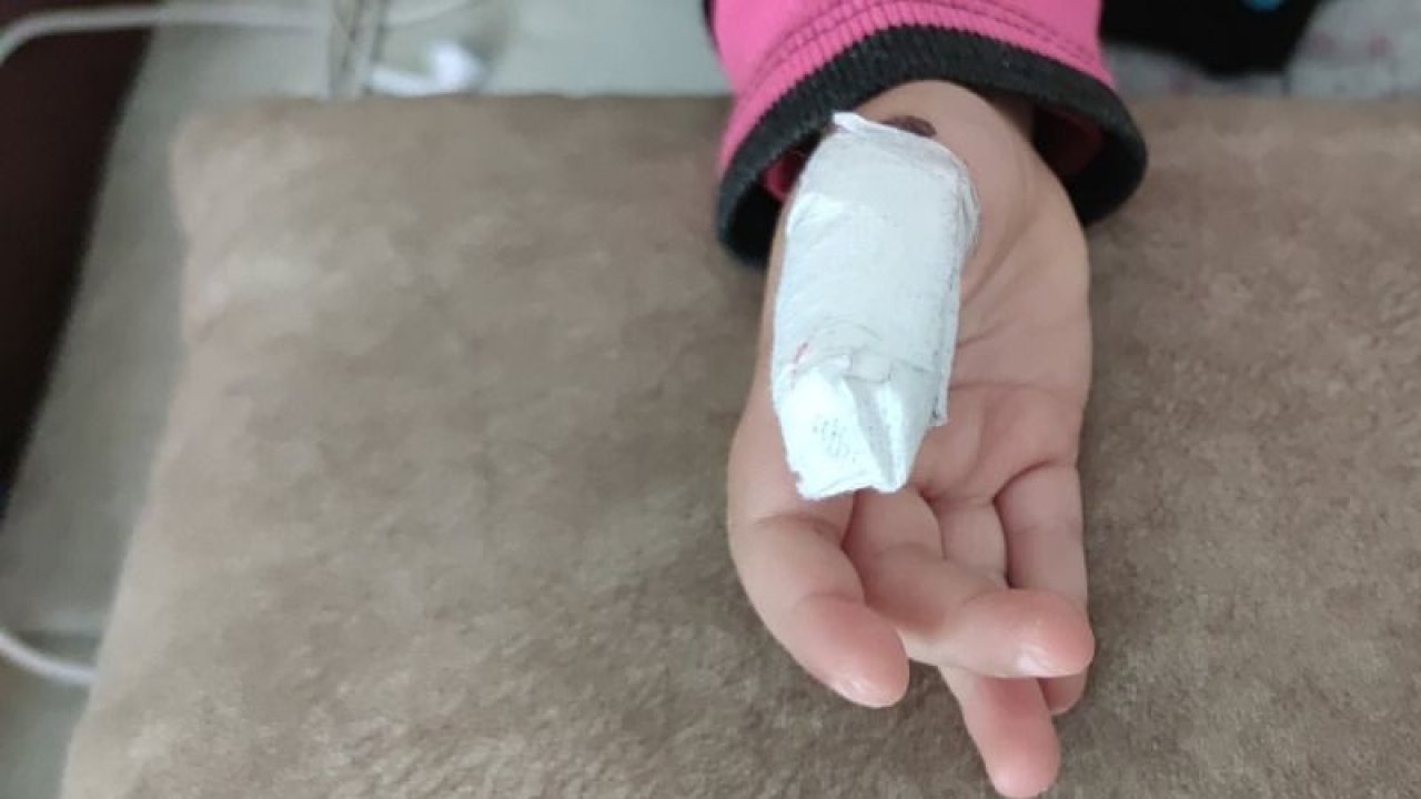 Son Dakika...Gaziantep'te Sağlıkta Skandal…Küçük Çocuğu Kopacak Parmakla Hastane Hastane Gezdirttiler…
