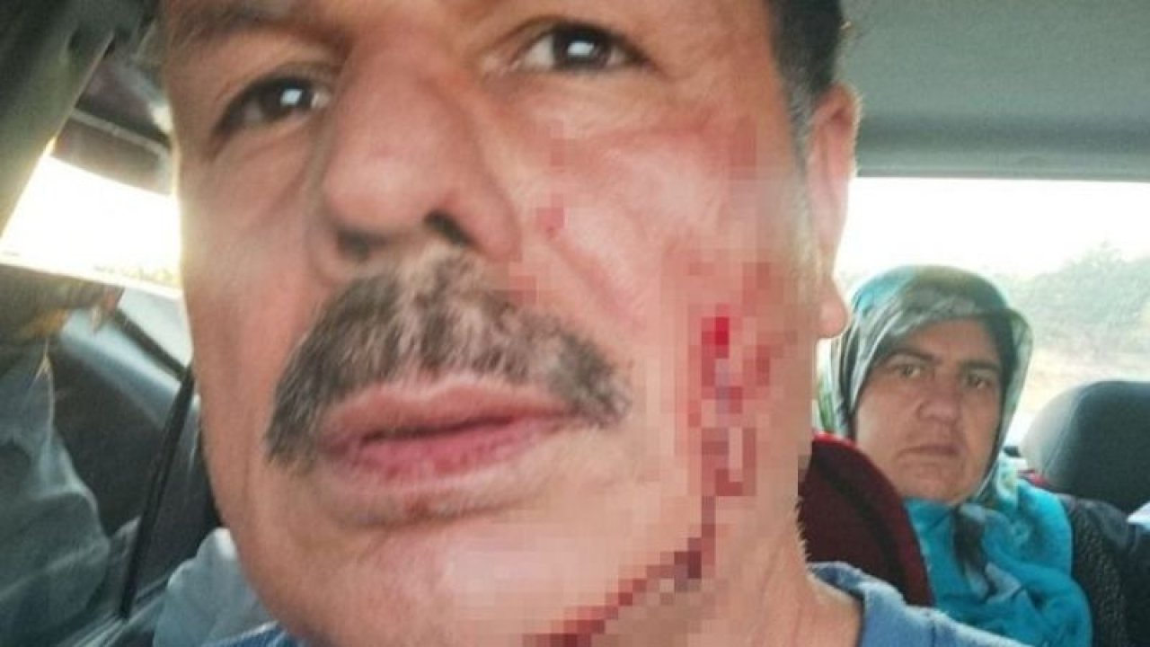 Son Dakika:Foto Haber...Gaziantep'te Engelli adam kızının eski eşi tarafından darp edildi