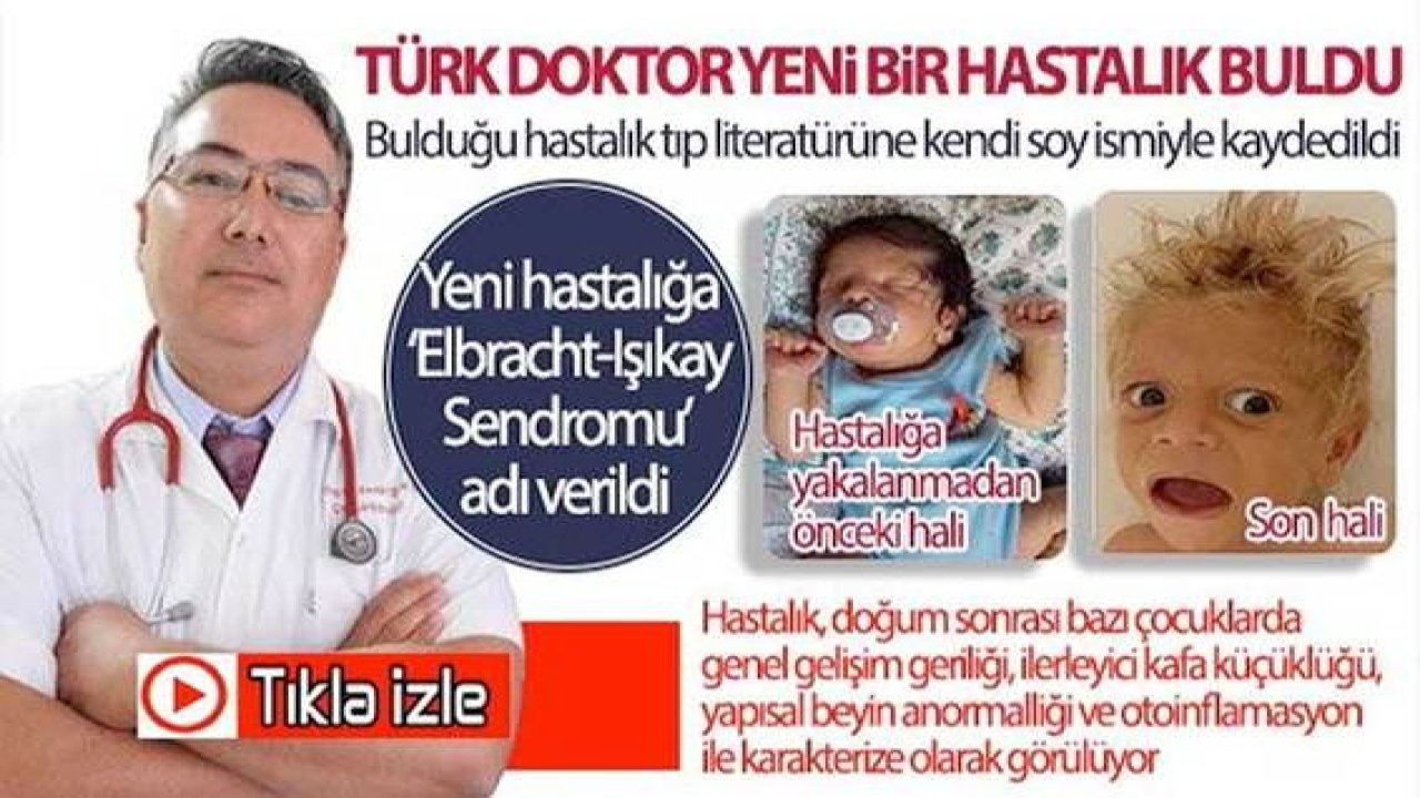 Video Haber...Türk doktorun keşfettiği hastalık tıp literatürüne soyismiyle kaydedildi
