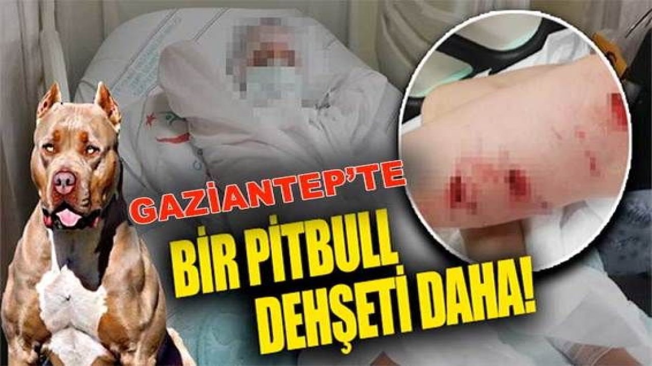 Son Dakika: Gaziantep'te pitbull dehşeti durdurak bilmiyor