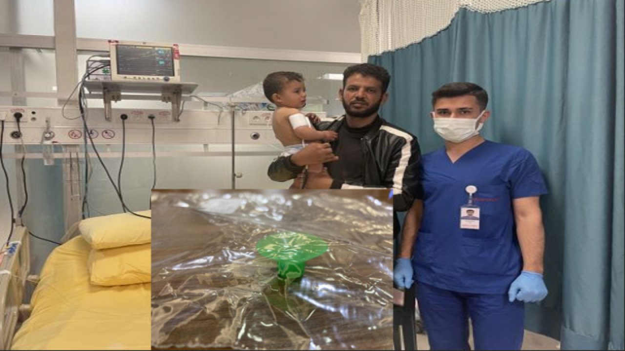 Gaziantep'te soluk borusuna plastik oyuncak kaçan 1,5 yaşındaki çocuk operasyonla kurtarıldı