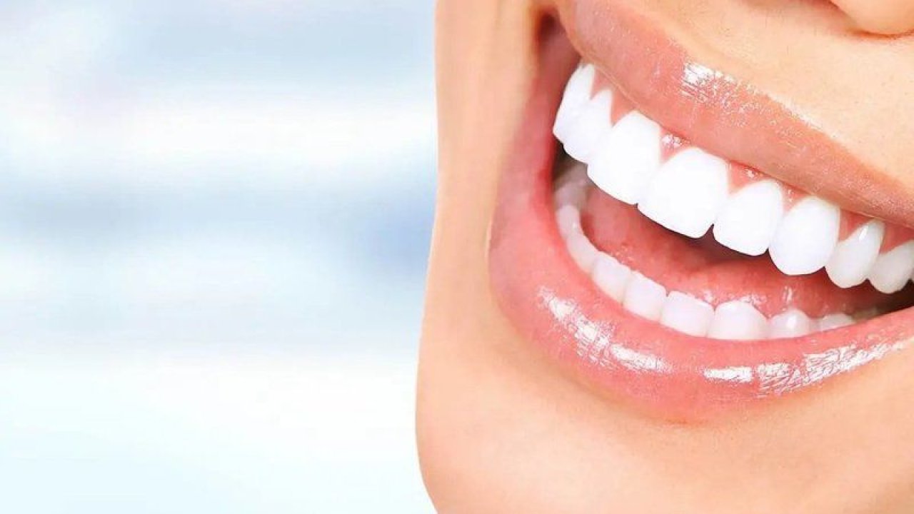 Bu yöntem ile dişçiye gitmeye gerek kalmadı! Bembeyaz dişlerin sırrı…