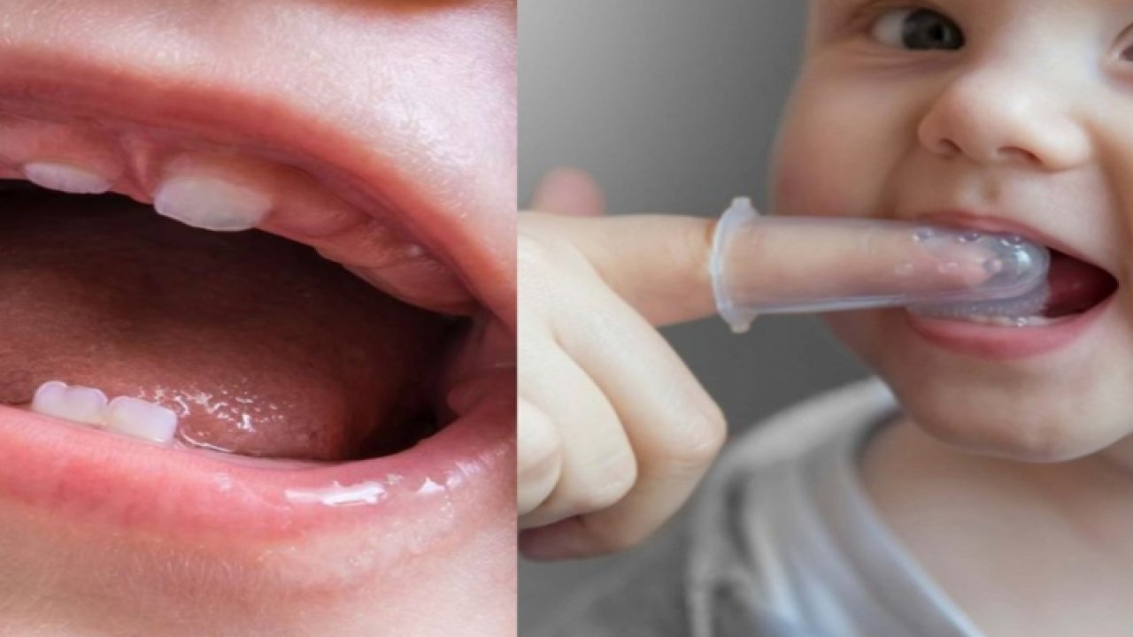 Bebeklerde diş çıkarma ağrısını hafifletmek için doğal yöntemler. Diş çıkarmak ağrıya neden olur mu? İpuçları ve pratik bilgiler.